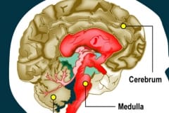 Brain_L